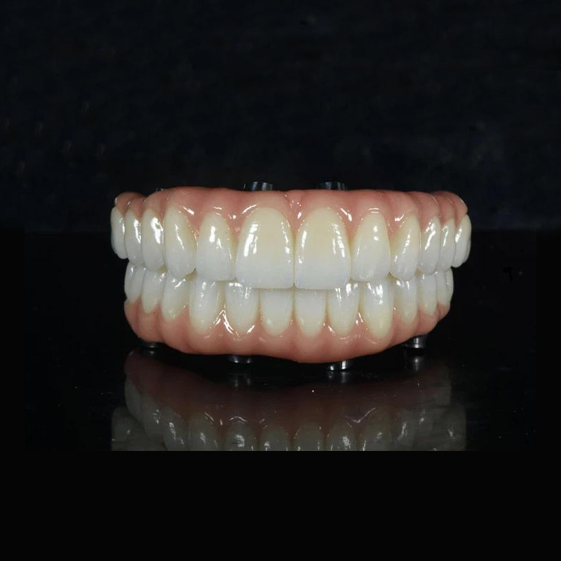 ALL-ON -X ZIRCONIA BRIDGE