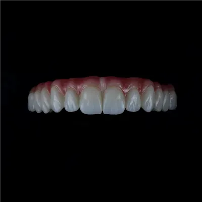 How to Send Digital Scans to a China Dental Lab: Step-by-Step Workflow