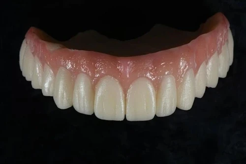 Metal-Free Crowns: Why Dentists Are Switching in 2026