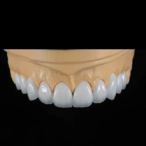 When Should Dentists Recommend Dental Veneers?