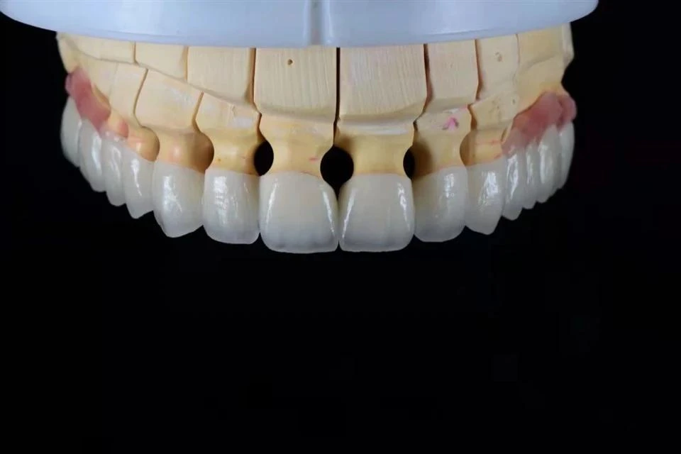 High Translucency Zirconia Crown High Translucency Zirconia Crown