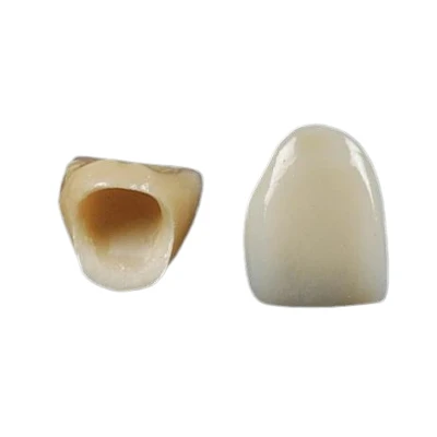 All Ceramic Crown