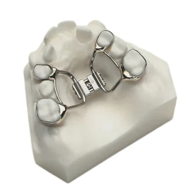 Orthodontic Appliances