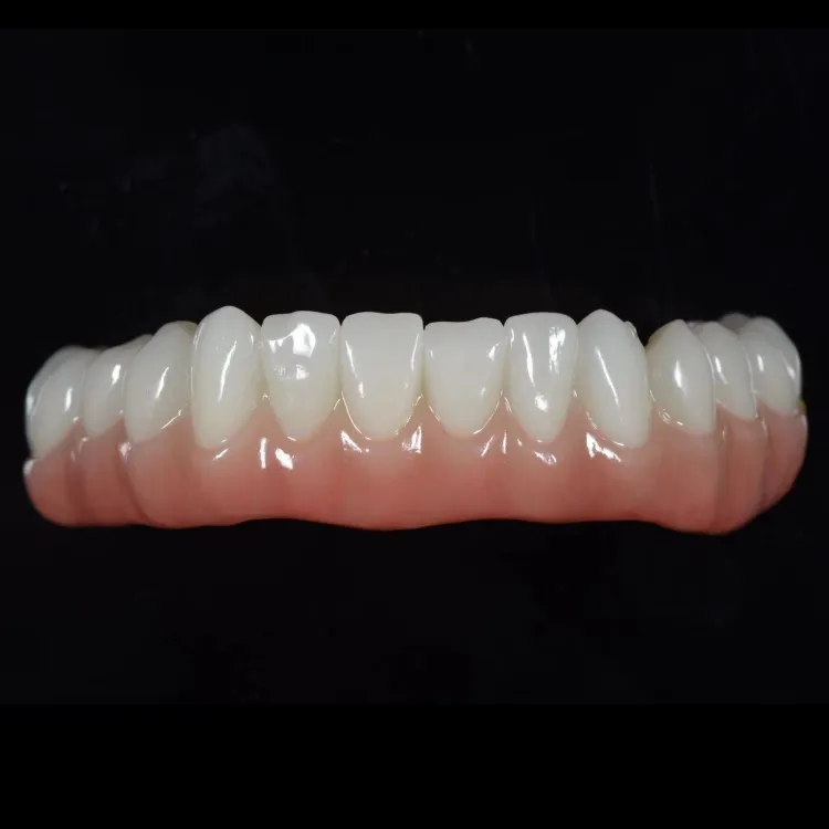 Full arch zirconia bridge with customized pink gingiva contour Full arch zirconia bridge with customized pink gingiva contour
